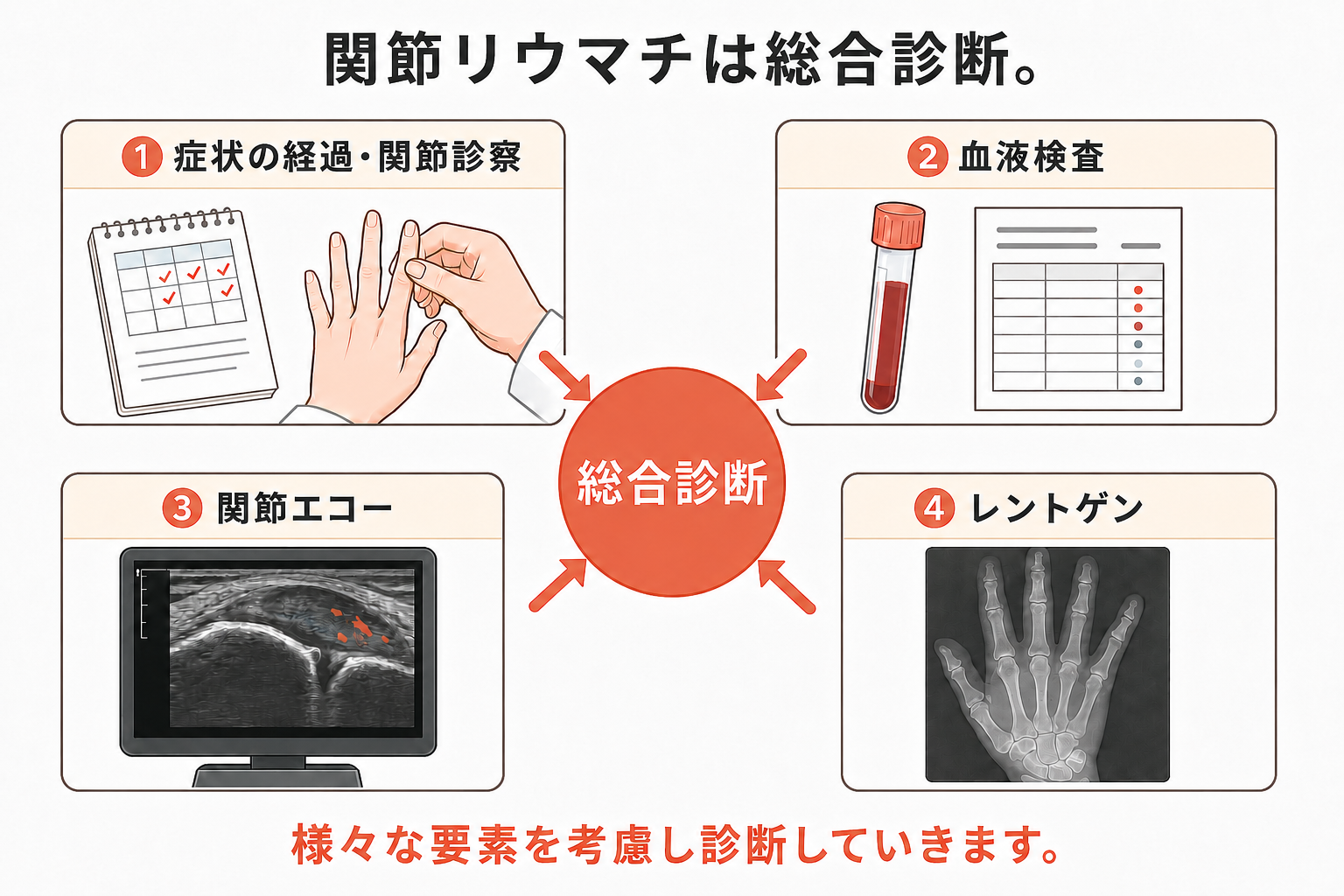関節リウマチの診断過程